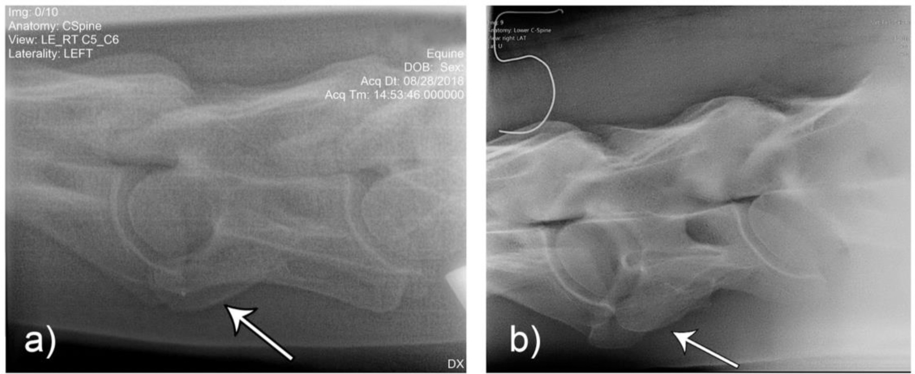 Abb. 10: Laterolaterale Röntgenaufnahmen von Pferd F1 (a) und M2 (b) als Beispiele der ECVM-Ausprägungen — unilateral (F1) sowie bilateral mit beidseitiger Transposition auf C7 (M2). Die Pfeile markieren die abnorme Konturlinie der Lamina bei fehlender kaudaler Lamina des Querfortsatzes. Quelle: Gee et al. 2020, Animals 10(4):667, DOI 10.3390/ani10040667 — CC BY 4.0, Bildunterschrift übersetzt.