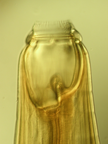Mikroskopische Aufnahme der Mundkapsel von Strongylus vulgaris, dem Großen Pferde-Strongyliden